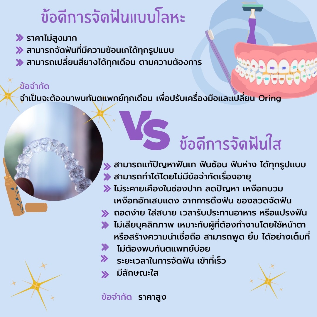การจัดฟันใส หาดใหญ่