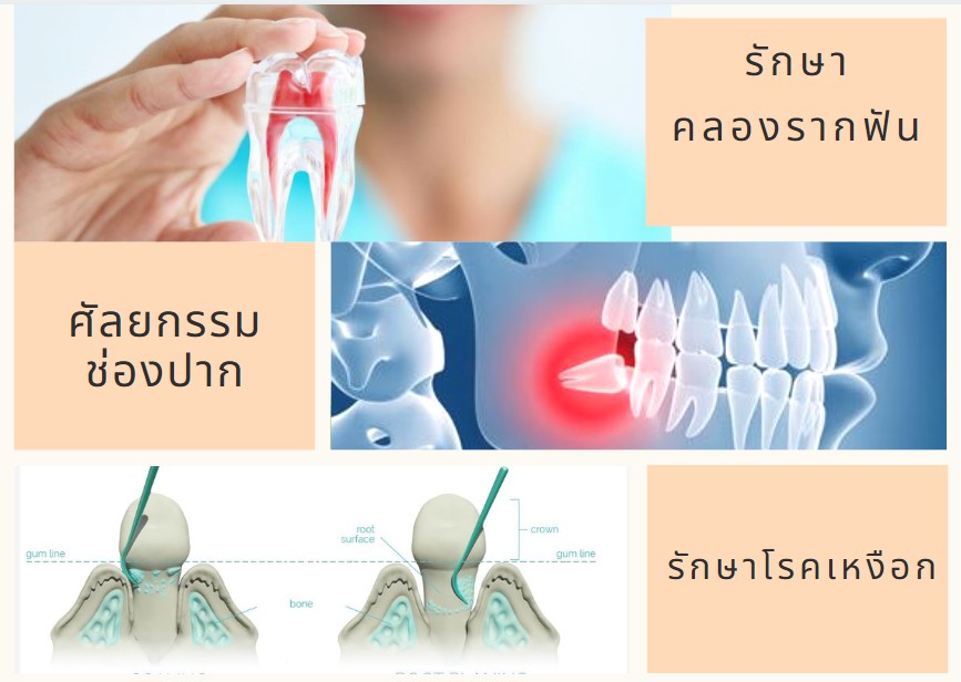   คลินิก หาดใหญ่ที่ไหนดี  จัดฟัน ดัดฟัน หมอฟัน  ปรึกษา ทำฟัน ปุณณกัณฑ์ทันตแพทย์ 108