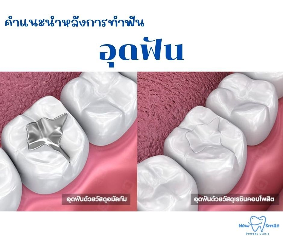 ทันตแพทย์  คลินิก หาดใหญ่    จัดฟัน ดัดฟัน หมอฟัน  ปรึกษา ทำฟัน